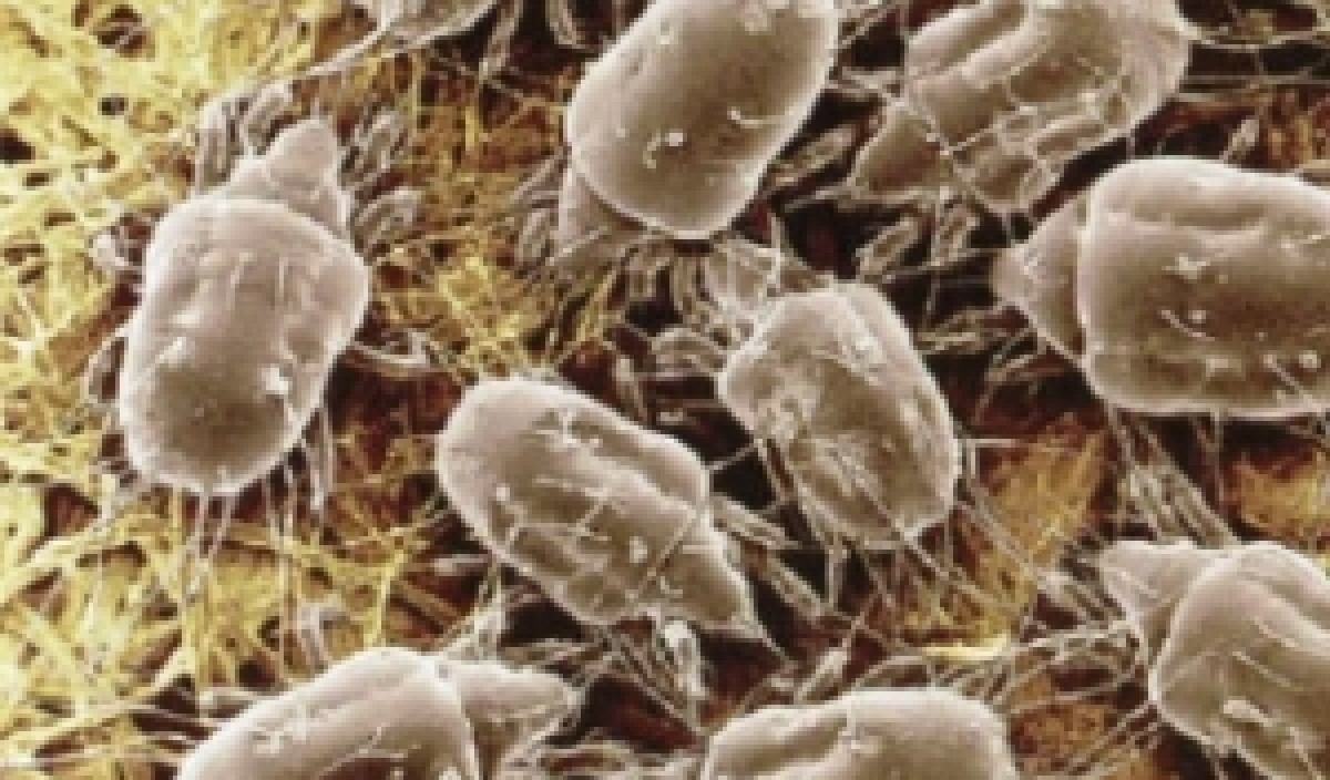 dust mite bites allergic reaction
